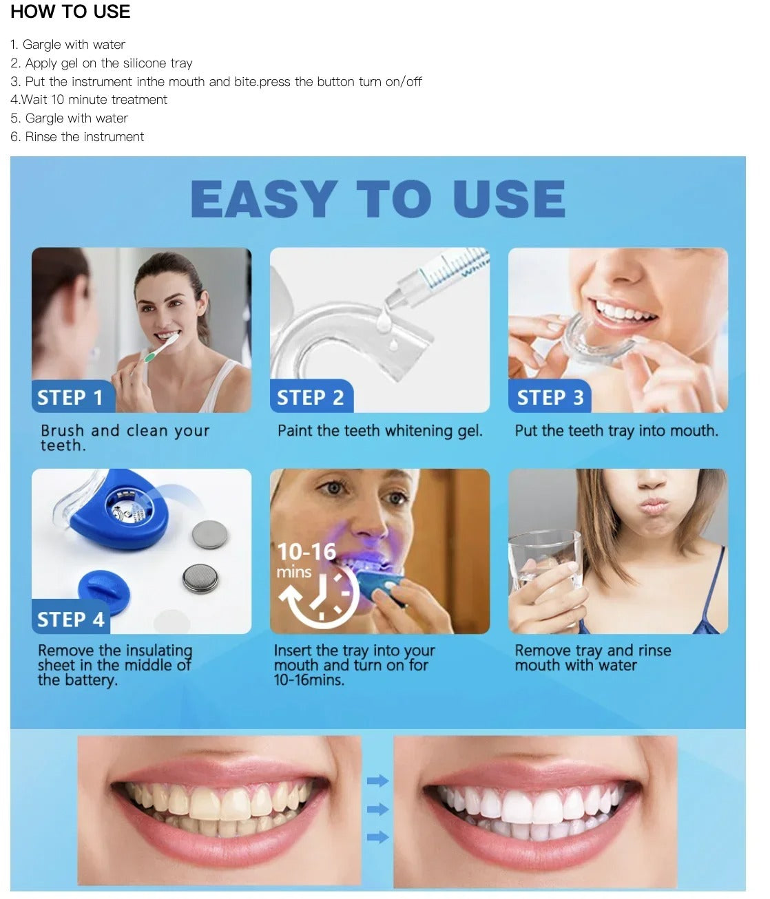 Dental Whitening